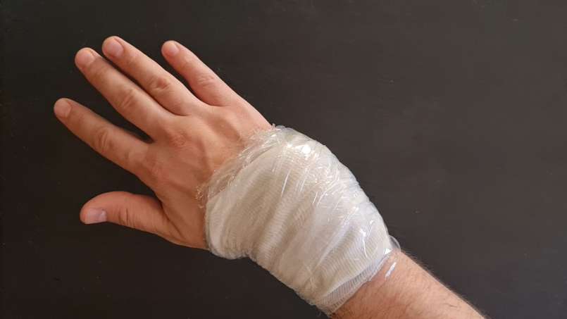 Grötomslag med loys och kålblad, foto 7