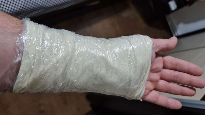 Grötomslag med loys och kålblad, foto 8